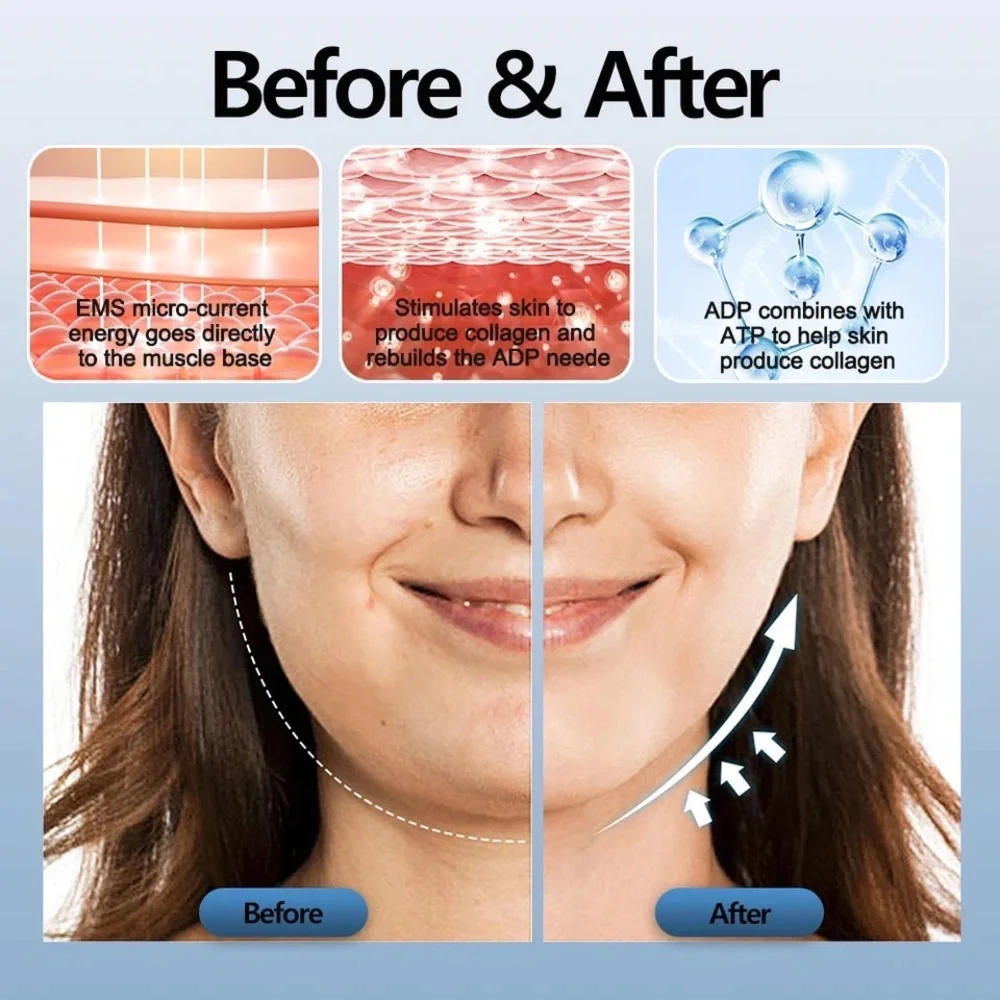V-Face Beauty Device EMS Face Lifter